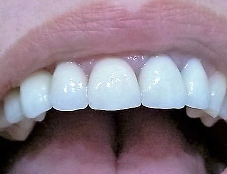 Clínica Dental Catoira Dra. Lorena Busto dientes saludables