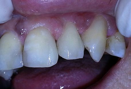 Clínica Dental Catoira Dra. Lorena Busto dientes sanos