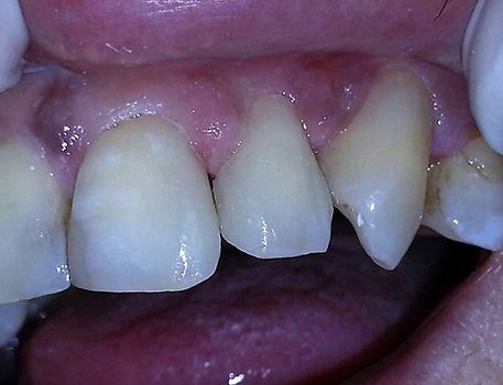 Clínica Dental Catoira Dra. Lorena Busto dientes sanos